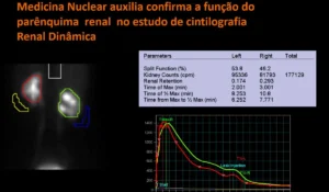 Cintilografia Renal Dinamico grafico